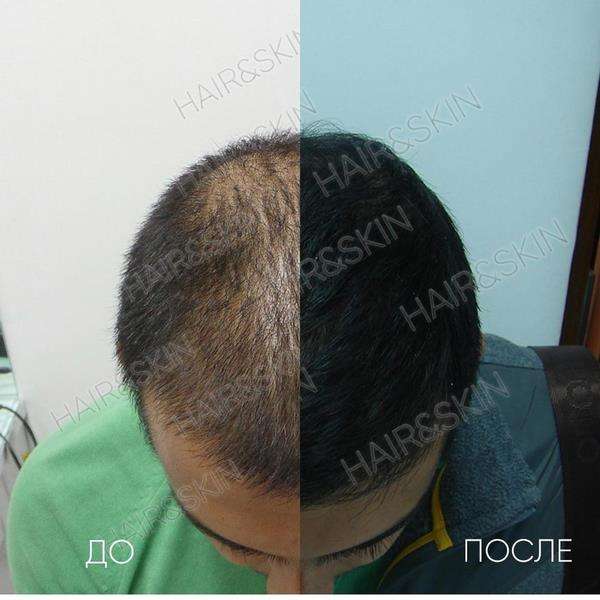 На фото – восстановление волос. Результаты «до» и «после»