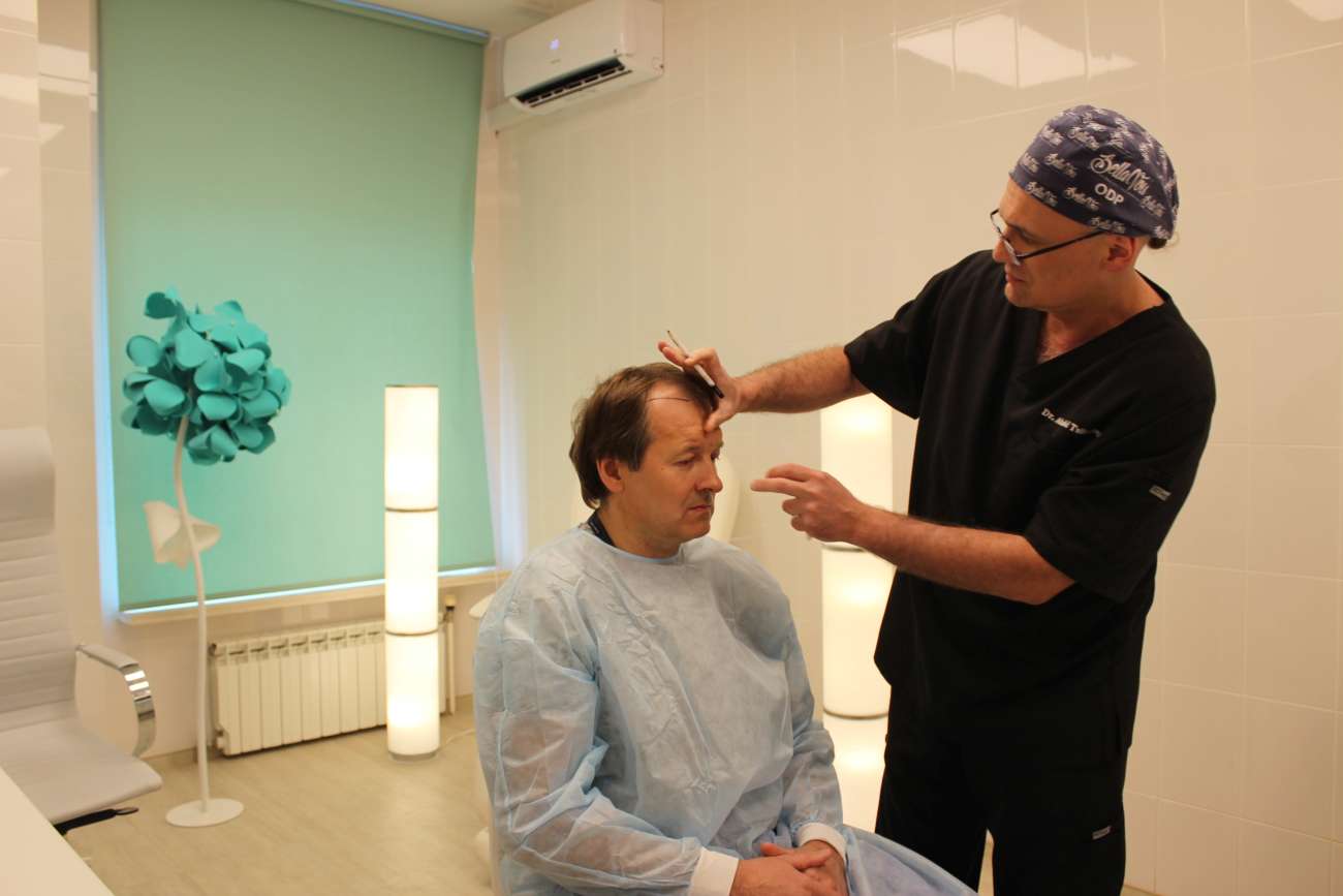 Процедура пересадки волос